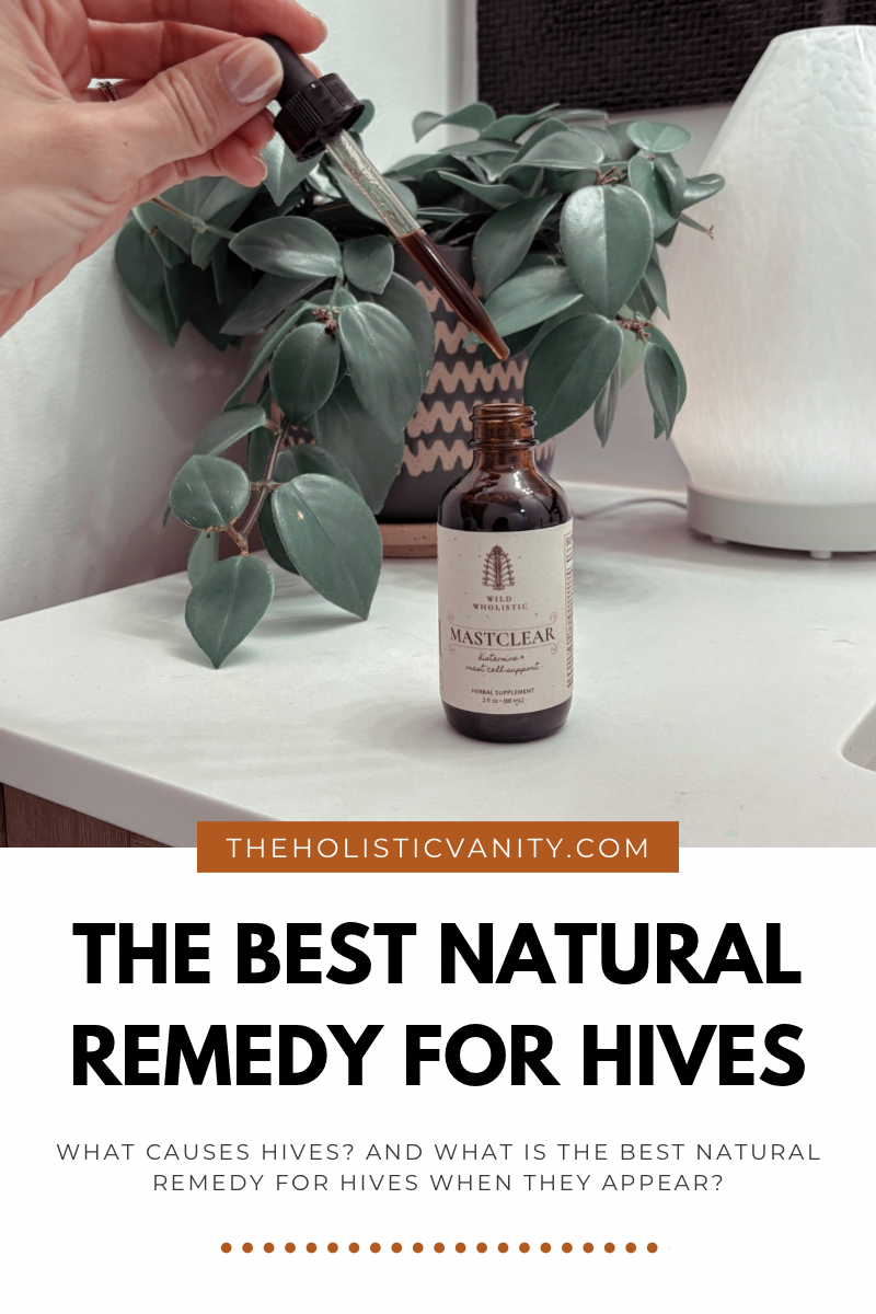 Best Natural Remedy for Hives - How to Soothe Rash and Itching Naturally 